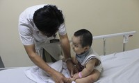 Bác sĩ khám cho trẻ mắc bệnh tay chân miệng 