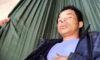 Nam thanh niên ở Quảng Trị bị trâu húc thủng bụng trong rừng sâu