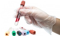 Một lần xét nghiệm máu phát hiện 13 loại ung thư