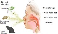 Triệu chứng và các tác nhân gây viêm mũi dị ứng.