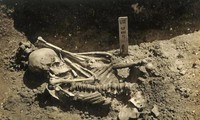 100 năm sau khi khai quật được hài cốt người tiền sử cụt chân Tsukumo số 24, cái chết kinh hoàng của nạn nhân mới được các nhà khoa học giải mã.