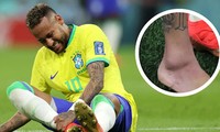 Brazil &apos;lo sốt vó&apos; với chấn thương của Neymar