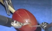 Màn ‘phẫu thuật’ hoàn hảo đến từng milimet của robot