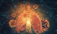 Các nhà nghiên cứu lập bản đồ tế bào của phổi để tìm ra cơ chế hoạt động và gây chết người của nó cũng như tìm ra thuốc đặc trị.