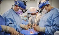 Kỳ tích y học: Cấy ghép thành công hai quả tim lợn cho bệnh nhân chết não 