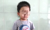 Bé trai 2 tuổi bị bỏ rơi trước cổng Tuệ Tĩnh đường ở Huế