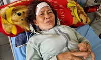 Nạn nhân kể phút hoảng loạn kêu cứu trên xe khách bị tai nạn ở Quảng Nam