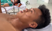 Nạn nhân bàng hoàng kể lại phút xe chở CLB bóng đá trẻ Quảng Nam lật khiến 3 người thương vong 
