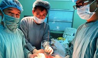 Phẫu thuật nội soi lấy lưỡi và dây câu từ bụng nữ bệnh nhân N.T.Ng.
