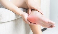 Những dấu hiệu khác thường trên bàn chân cho thấy sức khỏe của bạn đang ‘kêu cứu’