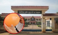 Đắk Lắk: 31 học sinh Tiểu học bị ngộ độc sau khi nhận và thổi bóng bay từ người lạ