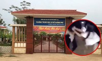 Nữ sinh lớp 7 ở Quảng Bình bị nhóm bạn hành hung đến mức phải nhập viện