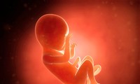 Theo Viện Guttmacher, ở Mỹ năm 2014 có 926.200 trường hợp phá thai (tỷ lệ 14,6 ca/1.000 phụ nữ 15-44 tuổi). Ảnh: New Idea.