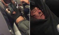 Bác sỹ người Mỹ gốc Việt David Dao bị các nhân viên an ninh cưỡng chế ra khỏi máy bay của hãng United Airlines.