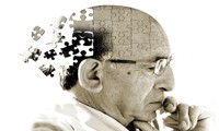 Ngủ nhiều làm tăng nguy cơ mắc bệnh Alzheimer