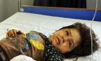 Một bé gái bị thương trong vụ nổ gần quảng trường Tahrir, Damascus, ngày 2/7. Ảnh: Tân Hoa Xã