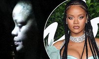 Rihanna lộ mặt tím bầm, sưng húp khiến fan lo lắng
