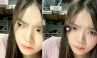 Dân mạng ‘sốc’ vì nữ idol Trung Quốc thổ huyết khi đang livestream