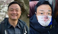 Tài tử Hong Kong gây sốc với hình ảnh mũi đầy máu sau xét nghiệm COVID-19