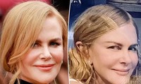 Mặt mộc của ‘Thiên nga nước Úc’ Nicole Kidman ở tuổi 55 gây tranh cãi