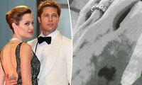 Lộ ảnh chụp thương tích của Angelina Jolie trong vụ xô xát với Brad Pitt trên máy bay