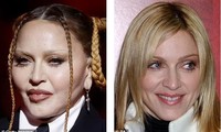 Bác sĩ thẩm mỹ nói về khuôn mặt không thể nhận ra của Madonna