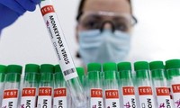 Bộ Y tế thông tin chi tiết sức khoẻ ca bệnh đậu mùa khỉ đầu tiên tại Việt Nam