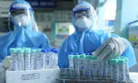 1,3% mẫu xét nghiệm trong cộng đồng ở TPHCM dương tính SARS-CoV-2