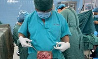 Đắp lá điều trị, người phụ nữ mang khối ung thư đến 30 cm ở &apos;vùng kín&apos; 