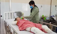 Người phụ nữ mất cả tứ chi vì điện giật khi dùng cây sắt hái xoài cho con