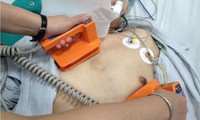 Hơn 30 lần sốc điện cứu bệnh nhân thoát khỏi &apos;cơn bão điện học&apos;
