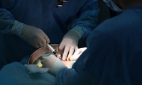 Cô gái biến dạng ngực, cấp cứu vì tiêm chất làm đầy để &apos;nâng cấp vòng 1&apos;