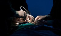 Sau phẫu thuật thẩm mỹ, cô gái trẻ nguy kịch vì xuất huyết não 