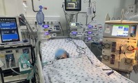 Bé gái nguy kịch vì bầy ong vò vẽ tấn công