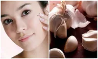 Ảnh minh họa từ Internet