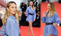 Mặc váy như pyjama của chồng, siêu mẫu Nam Phi khoe chân dài mê mải