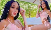 Winnie Harlow thư giãn bên hồ bơi với bikini nhỏ xíu