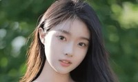 Nữ người mẫu bị bỏng nặng sau vụ nổ khí gas