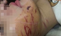 Vụ cô gái bị lột đồ, đổ nước mắm lên người: Triệu tập 2 đối tượng