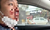 Thầy giáo bị hành hung, cướp tài sản trên đường