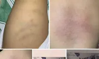 Tin mới vụ nghi bạo hành bé 1 tuổi tại nhà trẻ ở Bình Thuận