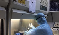 Kiểm tra các mẫu bệnh phẩm COVID-19 (Viện Pasteur TPHCM kiểm tra các mẫu bệnh phẩm được gửi tới)