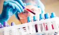 Thần tốc truy vết, khoanh vùng nơi có người mắc COVID-19 (ảnh: HCDC)