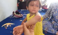 Làm rõ vụ bé gái 4 tuổi bị cha nuôi đánh gây thương tích 