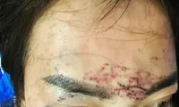 Vụ 'tố' bị bắt giữ, đánh đập, xăm mặt vì ghen: Khởi tố 2 người phụ nữ