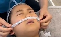 Ám ảnh sợ xấu, cô bé 9 tuổi phẫu thuật thẩm mỹ 