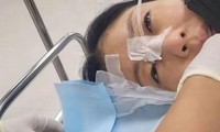 Showbiz 13/7: Nữ ca sĩ cấp cứu vì tổn thương giác mạc khi quay phim
