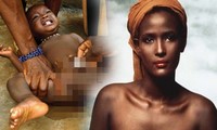 Ám ảnh kinh hoàng về quá khứ bị cắt bỏ âm vật của siêu mẫu gốc Phi 