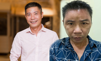 &apos;Hốt hoảng&apos; trước gương mặt sưng vù của NSND Công Lý 