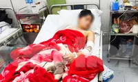 Nam sinh Lào Cai kể phút kinh hoàng bị hai con chó gần 60 kg thả rông cắn